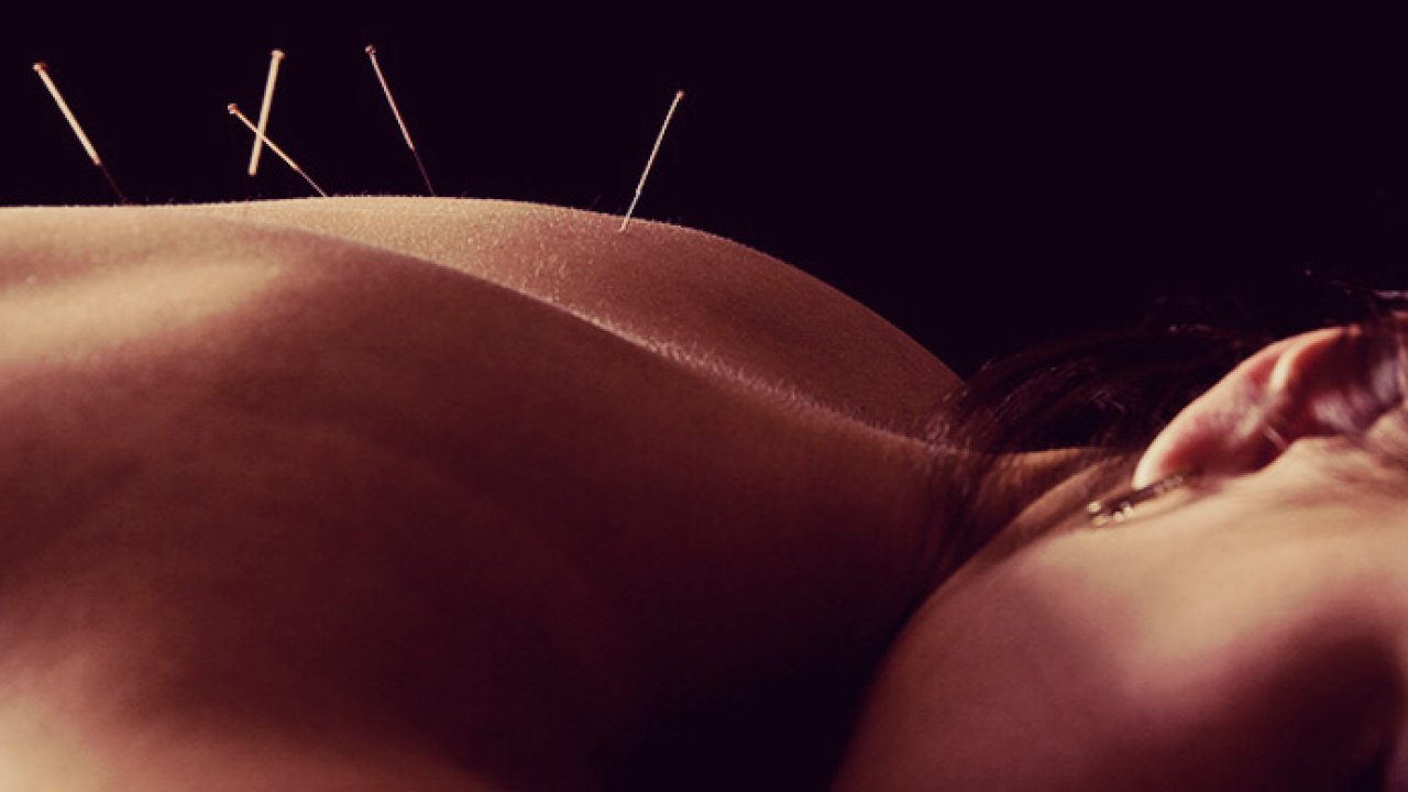 Integrative Dry Needling